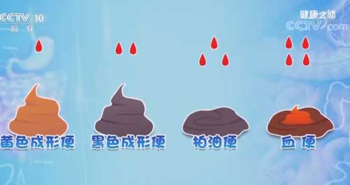 没有喝咖啡，呕吐物却是咖啡色！警惕这是胃出血