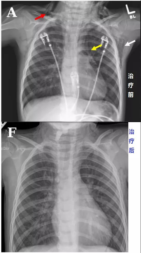 微信图片_20200425210708.jpg 微信图片_20200425210708.jpg